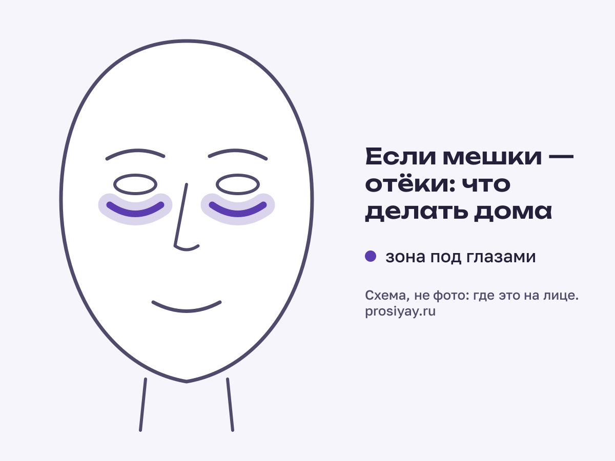 Если мешки — отёки: что делать дома: зона процедуры — зона под глазами